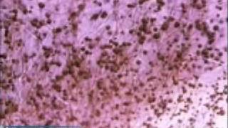 Penicillium Mold Growth [upl. by Refynnej]