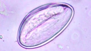 SCARY Moving human pinworm  movement inside the egg  Enterobius vermicularis [upl. by Inihor]