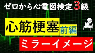 心電図【心筋梗塞】【ST上昇】【ST低下】【ミラーイメージ】ゼロから心電図検定3級 [upl. by Junius439]