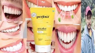 Perfora Awake Toothpaste  Honest Review [upl. by Notluf]