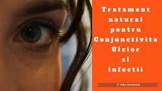 Tratament natural pentru Conjunctivita Ulcior sau Infectii la ochi [upl. by Adnorehs622]