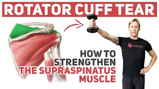 Rotator Cuff Tear How to Strengthen Supraspinatus [upl. by Furlani]