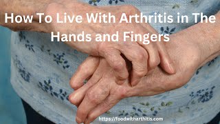 How to Live With Arthritis in The Hands and Fingers [upl. by Hael116]