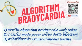 Algorithm Bradycardia with pulse และสาธิตวิธีการทำ Transcutaneous Pacing [upl. by Airamesor]