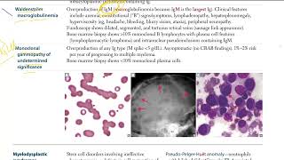 38 Plasma cell dyscrasias  Multiple Myeloma  Waldenstrom macroglobinemia  MGUS [upl. by Noni]