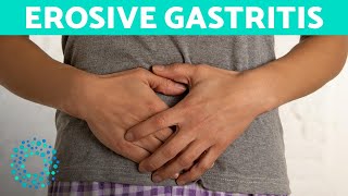 EROSIVE GASTRITIS  Belly Pain And Vomiting [upl. by Gratiana]