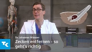 Zecken entfernen  so gehts richtig  Dr Johannes Wimmer [upl. by Ecinnahs]