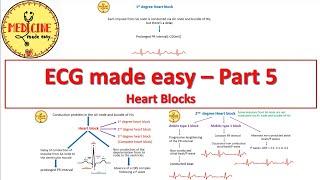 ECG made easyPart 5Heart blocks [upl. by Ecirted40]