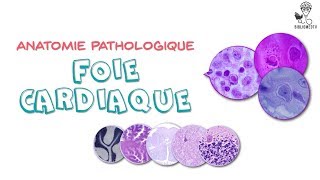 Anatomie Pathologique  le Foie Cardiaque [upl. by Therine]