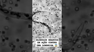 GLÓBULOS BRANCOS EM AÇÃO CONTRA UMA LOMBRIGA 😱 laboratory motivation imunidadebaixa doenças [upl. by Grier]