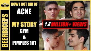 Goodbye Forever ACNE  Pimples Treatment 101  BeerBiceps Acne amp Fitness [upl. by Grantley287]