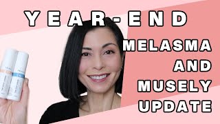 YearEnd Melasma amp Musely Update [upl. by Inihor]