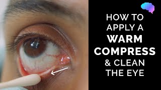 How to Apply a Warm Compress amp Clean the Eye  Eye First Aid  OSCE Guide  UKMLA  CPSA [upl. by Arimas388]