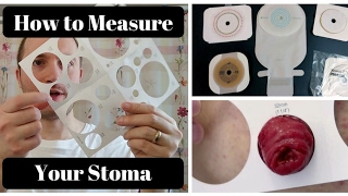 How to Measure Your Stoma OSTOMY TIPS [upl. by Carlson]