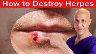 How to Destroy HERPES  Dr Mandell [upl. by Deach667]