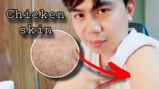 Proven EFFECTIVE to minimize CHICKEN SKIN  Nurse tips [upl. by Sedecrem18]