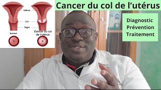 La Biopsie du Col Conisation Dépistage précoces Lésions précancéreuses 3 Minutes [upl. by Ahsakal146]