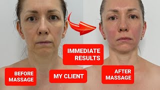 LIFTING MASSAGE for Sagging Jowls and Saggy cheeks muscles [upl. by Ailahs]