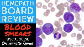 Hemepath amp Hematology Board Review Peripheral Blood Smears with Dr Jeanette Ramos [upl. by Mert376]