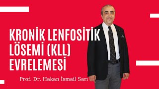 Kronik Lenfositik Lösemi KLL Evrelemesi  KLL RAİ Evrelemesi [upl. by Balfour]