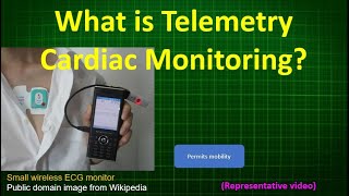 What is Telemetry Cardiac Monitoring [upl. by Dore]