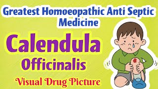 Calendula Officinalis Homoeopathic Mother Tincture UsesSymptoms  Antiseptic for Cuts Wound [upl. by Juno776]