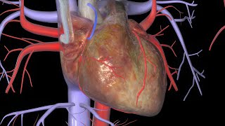 Heart Bypass Surgery CABG [upl. by Adran]