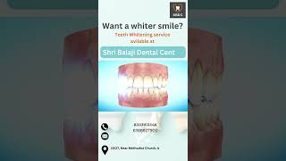 whitening teeth service  SBDC [upl. by Ained]