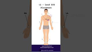 12  Lead ECG Placement ecg viral trendingshorts [upl. by Adlai396]