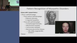 RRNMF  Pattern Recognition of Myopathic Disorders [upl. by Eanert971]