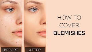 Tutorial effective covering of blemished skin and spots  ARTDECO [upl. by Etnelav]