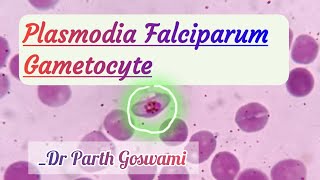 Plasmodia Falciparum Gametocyte  Morphology in Peripheral blood smear [upl. by Savdeep816]