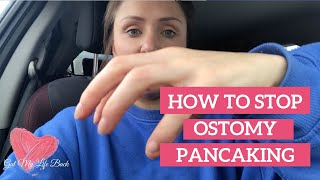 OSTOMY CARE TIPS DEALING WITH PANCAKING  WHAT IS PANCAKING [upl. by Eelesor]