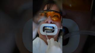 Teeth Whitening ASMR [upl. by Yromas]