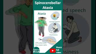 Spinocerebellar ataxia SCA  pathology diagnosis and treatment  1 minute pathology [upl. by Ellynad]