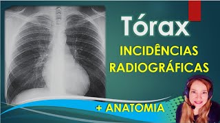 Vídeo Aula 18 Tórax Incidências Radiográficas  Anatomia [upl. by Ijnek360]