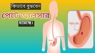 পেটে আলসার হয়েছে কিভাবে বুঝবেন  peptic ulcer  in bangla [upl. by Gayler133]