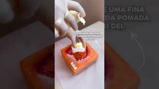 Ferida com muita umidade tratamentodeferidas maceracao curativo hidrogel [upl. by Araes582]