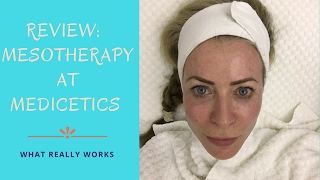 Review of Mesotherapy treatment at Medicetics clinic [upl. by Onailimixam]