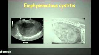 Abdominal ultrasound part 8 [upl. by Hannus]