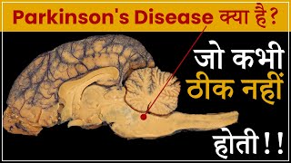 What is Parkinsons Disease  Nervous system diseases  TV Health shorts [upl. by Nosreh]