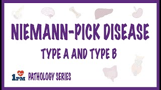 Niemann Pick Disease Type A and Type B  causes symptoms diagnosis treatment pathology [upl. by Alicea387]