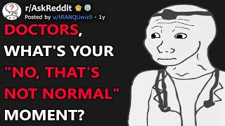 Doctors Whats Your quotNo Thats Not Normalquot Moment rAskReddit [upl. by Iccir]