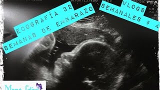 32 SEMANAS DE EMBARAZO ECOGRAFIA  8 MESES DE EMBARAZO  32 Weeks Pregnant  VLOG 4 [upl. by Parrie]