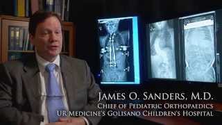 Life changing surgery for scoliosis patients [upl. by Louisette]