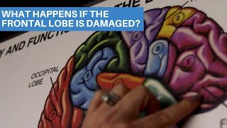 What Happens If The Frontal Lobe Is Damaged [upl. by Leor363]