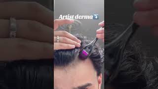 Derma Roller for Hair and Beard Growth dermaroller viralshorts howto newproducts fexicart [upl. by Nylacaj115]