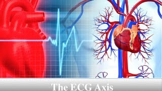 ECG Axis Tutorial Part 3  Determining QRS Axis [upl. by Sardse]