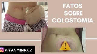 FATOS SOBRE COLOSTOMIA [upl. by Uzia]