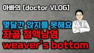 아빠의 doctor VLOG 몇달간 앉지를 못해요좌골 점액낭염 weaver’s bottom [upl. by Lienad80]